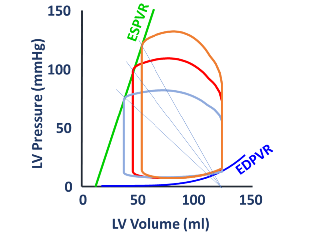 Chapter 4: Afterload