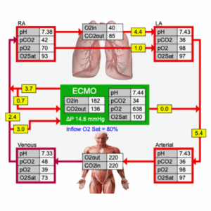 ECMO Workshop