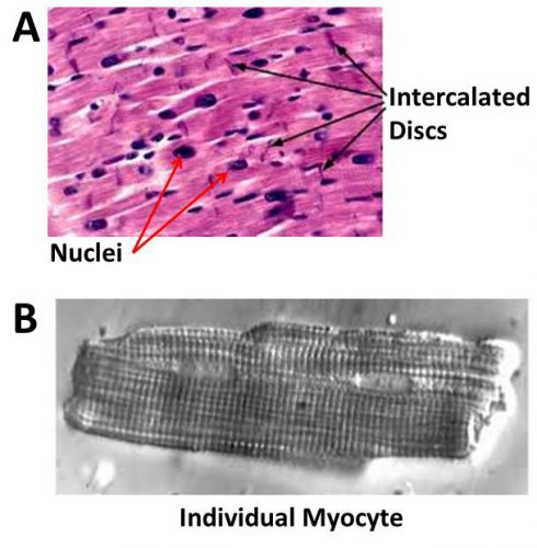 Figure 3-1. A. Histologic appearance of normal myocardium. B. The normal myocyte is ~25μ in diameter and ~100μ in length with typical striated appearance.