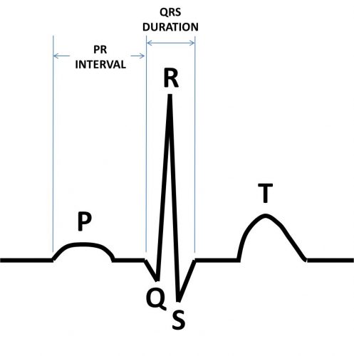 Figure 4-4. Typical ECG signal.